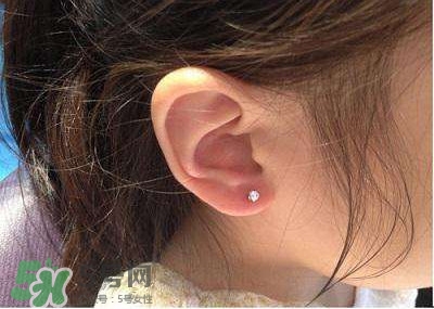 打耳洞后的注意事项几天转一次,打耳洞后的注意事项饮食