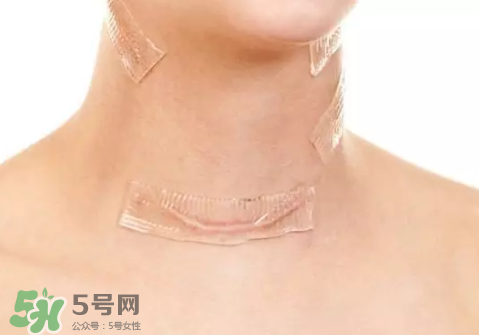 硅胶疤痕贴有用吗,硅胶贴片祛疤有效果吗