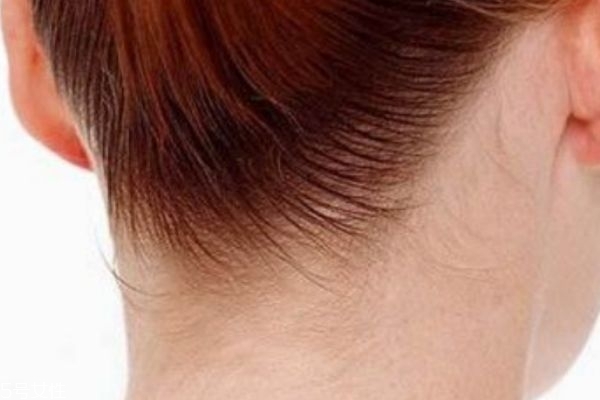 运动消除富贵包(做什么运动可以消除富贵包)