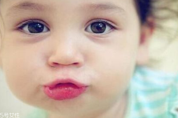 如何预防上火起泡(如何预防上火起泡)