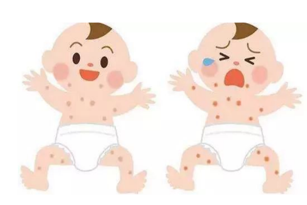 宝宝湿疹吃益生菌有用吗(宝宝湿疹吃益生菌有用吗?) 宝宝湿疹吃益生菌有用吗(宝宝湿疹吃益生菌有用吗?)