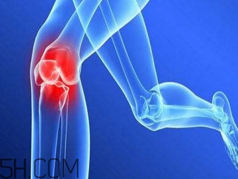 关节炎需要补钙吗,骶髂关节炎需要补钙吗