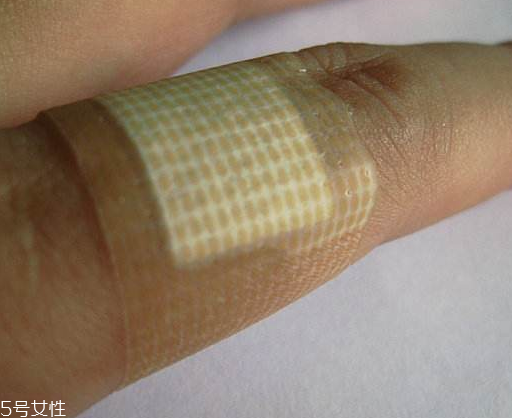 怎么做可以不留疤痕呢(怎样不留疤痕)