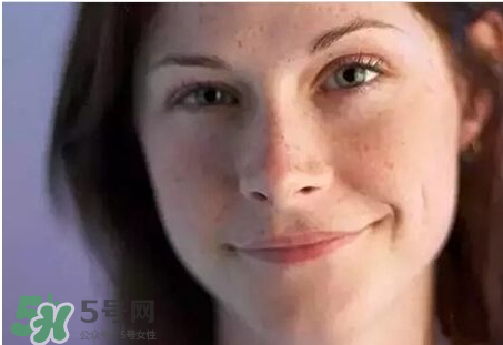 柿子叶和凡士林祛斑多久有效,柿子叶凡士林多久祛斑,脸会变黑吗