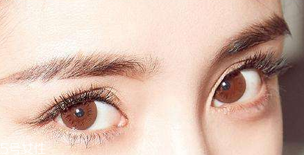 近视眼形成的原因(近视眼形成的原因是什么)