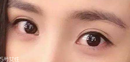 怎么防止高度近视遗传孩子(高度近视怎么避免遗传给孩子) 怎么防止高度近视遗传孩子(高度近视怎么避免遗传给孩子)