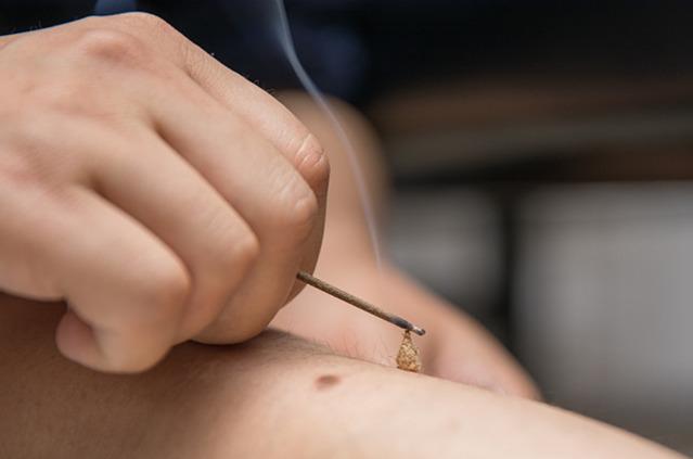 艾灸后出现的各种反应代表什么,艾灸后的反应和表现