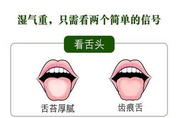 湿气重的舌苔表现,体内有湿的舌苔是什么样的