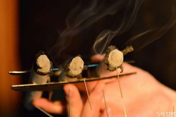 三九灸的好处和功效图片,小孩三九灸的好处和功效