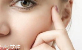 皮肤过敏怎么护理(皮肤过敏了怎么处理) 皮肤过敏怎么护理(皮肤过敏了怎么处理)