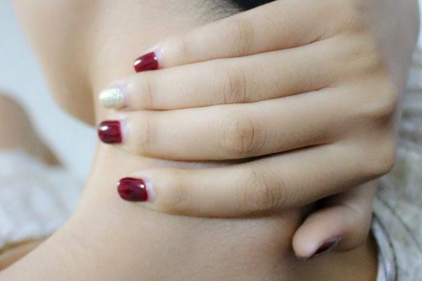 颈椎病的分型及临床表现,颈椎病分型及症状 颈椎病的分型及临床表现,颈椎病分型及症状