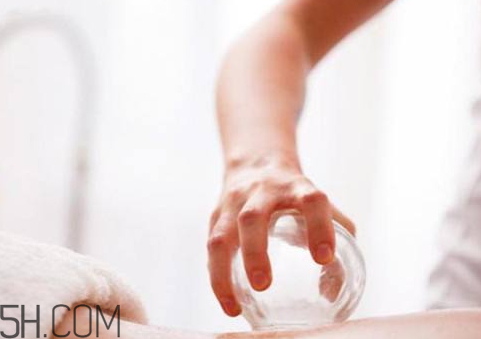 冬天 拔罐,冬天拔罐后注意什么 冬天 拔罐,冬天拔罐后注意什么