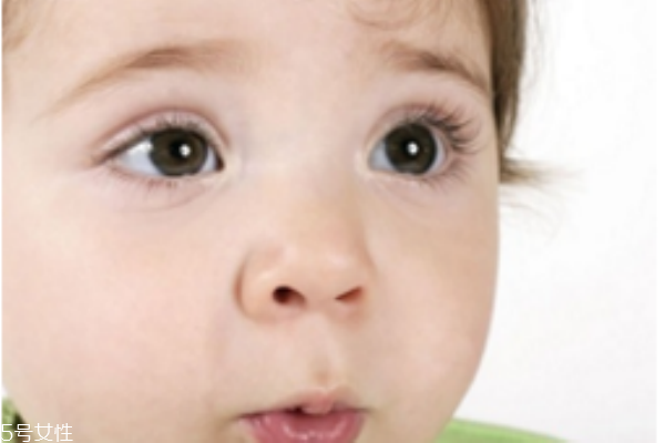 宝宝斗鸡眼怎么治疗(儿童斗鸡眼怎么矫正) 宝宝斗鸡眼怎么治疗(儿童斗鸡眼怎么矫正)