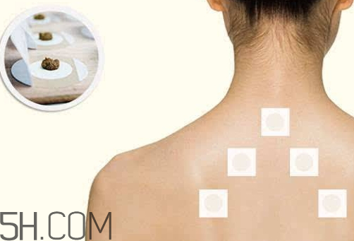 三伏贴配方和比例,三伏贴配方大全公布