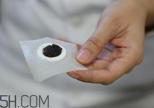 三九贴多大孩子可以贴,三九贴几岁可以贴