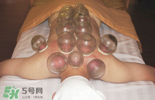 真空拔罐器的使用方法,真空拔罐注意事项有哪些