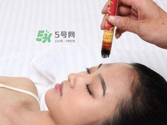 对艾灸过敏有什么反应,艾灸对荨麻疹有效果吗