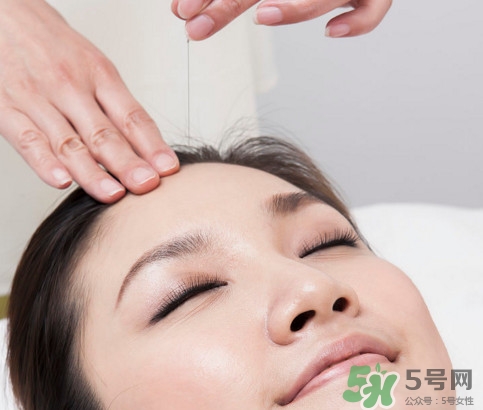 针灸最适合哪些病,针灸适合治疗哪些病