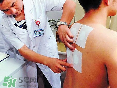 三伏灸是什么,三伏艾灸的好处和功效有哪些