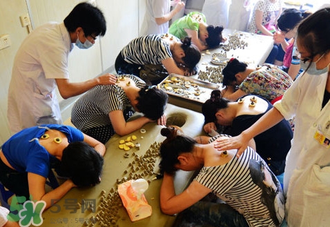 三伏灸不能吃什么,三伏灸不能吃什么食物 三伏灸不能吃什么,三伏灸不能吃什么食物