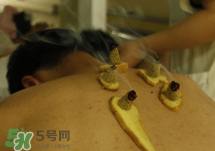 2020三伏天时间表,三伏灸的时间表