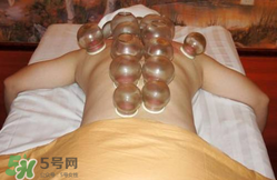 拔火罐的好处和功效,拔火罐的好处和坏处