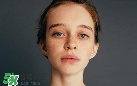 长斑是什么原因导致,长斑的原因有哪些