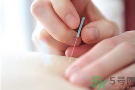 针灸可以几天做一次,针灸多久做一次可以每天做吗