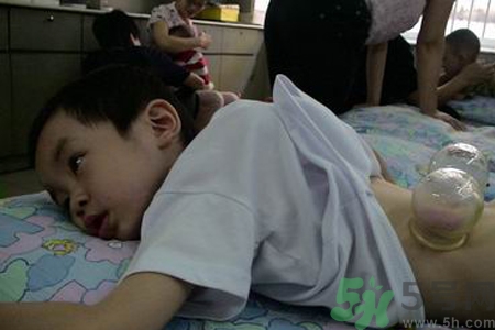 四岁宝宝能拔火罐吗,宝宝能拔火罐吗? 四岁宝宝能拔火罐吗,宝宝能拔火罐吗?