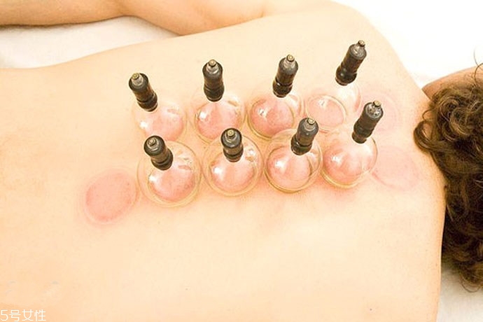 拔罐的注意事项有哪些(拔罐的注意事项有哪些?) 拔罐的注意事项有哪些(拔罐的注意事项有哪些?)