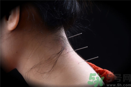 针灸晕针的原因及处理,针灸晕针的原因