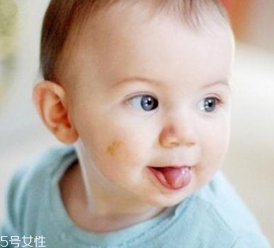 什么是胎记(什么是胎记?都分为哪几种) 什么是胎记(什么是胎记?都分为哪几种)