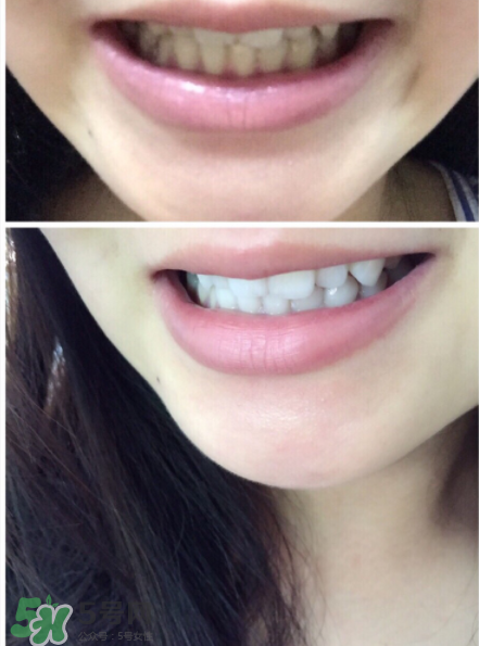 丙肝患者应吃高蛋白饮食(丙肝患者饮食注意哪些) 丙肝患者应吃高蛋白饮食(丙肝患者饮食注意哪些)