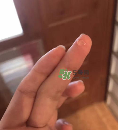 倍舒痕效果好还是疤克效果好,倍舒痕效果怎么样 倍舒痕效果好还是疤克效果好,倍舒痕效果怎么样