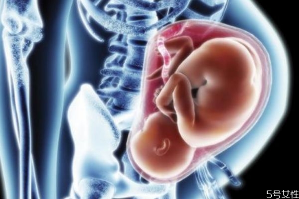 羊膜带对宝宝有影响吗,羊膜带是什么对胎儿健康吗 羊膜带对宝宝有影响吗,羊膜带是什么对胎儿健康吗