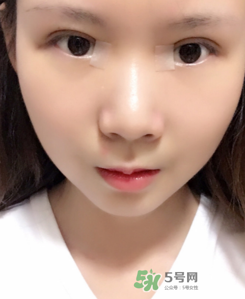 美皮护的作用,美皮护效果怎么样 美皮护的作用,美皮护效果怎么样