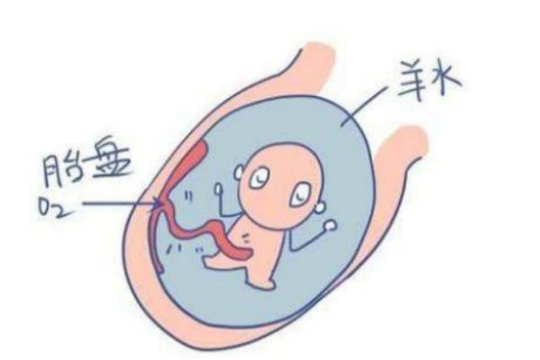 羊水过多会有什么影响,什么情况会导致羊水过多