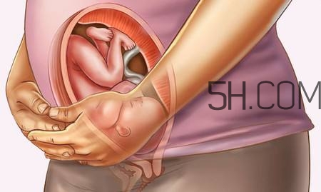 羊水破了会尿频吗,羊水破了之后老是想尿