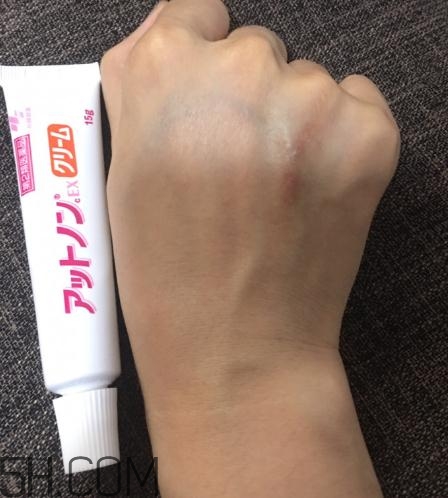 小林制药祛疤膏产品介绍(小林制药祛疤膏说明书)