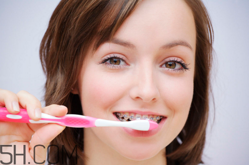 影响牙套佩戴时间的因素(牙套戴的时间越长越好吗) 影响牙套佩戴时间的因素(牙套戴的时间越长越好吗)