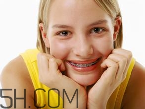 戴牙套的时间(牙套戴的时间越长越好吗) 戴牙套的时间(牙套戴的时间越长越好吗)