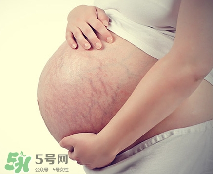 胸上的妊娠纹怎么去除,胸部妊娠纹怎么修复 胸上的妊娠纹怎么去除,胸部妊娠纹怎么修复