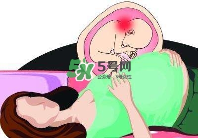 孕晚期左侧睡没有右侧睡舒服,怀孕后期左侧睡不舒服,能右侧吗