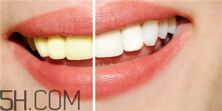 快速去除牙齿污垢(快速去除牙齿污垢) 快速去除牙齿污垢(快速去除牙齿污垢)