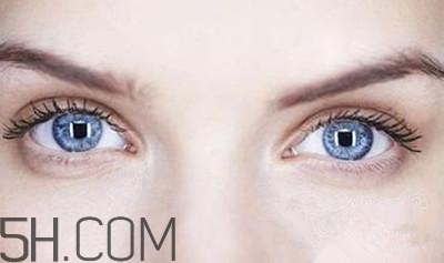 割完双眼皮不能吃什么(割完双眼皮不能吃什么水果)