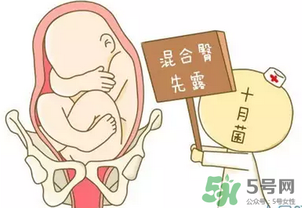 金戈小知识(金戈起什么作用)