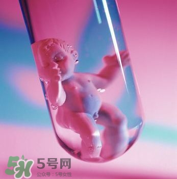 试管婴儿需要什么条件才可以做,做试管婴儿需要满足什么条件