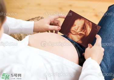 怎么预防妊娠纹的有效方法 最好的,怎样减少妊娠纹 怎么预防妊娠纹的有效方法 最好的,怎样减少妊娠纹