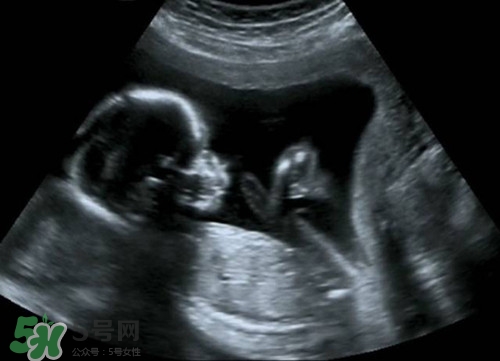 怀孕b超对胎儿有影响吗,怀孕做b超对胎儿有影响吗 怀孕b超对胎儿有影响吗,怀孕做b超对胎儿有影响吗