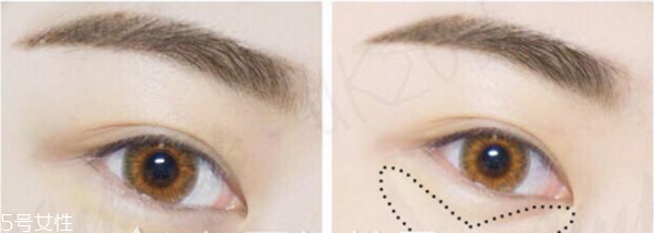 文艺发型明星示范(文艺短发发型)